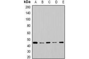 Western blot analysis of Cytochrome P450 2F1 expression in SW620 (A), BT474 (B), mouse lung (C), mouse liver (D), rat brain (E) whole cell lysates. (CYP2F1 antibody)