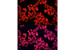 Immunofluorescence analysis of HeLa cells using ALAD antibody (ABIN6129891, ABIN6136749, ABIN6136751 and ABIN6216012) at dilution of 1:100. (ALAD antibody  (AA 1-330))