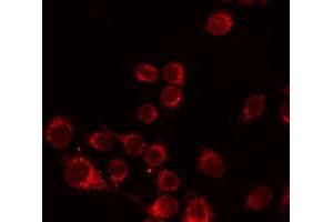 ABIN6276494 staining Hela by IF/ICC. (ALPL antibody  (Internal Region))