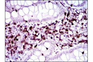 Immunohistochemistry (IHC) image for anti-CD7 (CD7) (AA 72-175) antibody (ABIN1846202) (CD7 antibody  (AA 72-175))