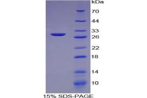 SDS-PAGE analysis of Human COL4a2 Protein.