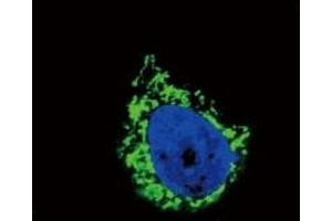 Confocal immunofluorescent analysis of IGFBP2 antibody with A549 cells followed by Alexa Fluor 488-conjugated goat anti-rabbit lgG (green).