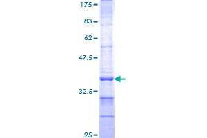 Image no. 1 for Diencephalon/mesencephalon Homeobox 1 (DMBX1) (AA 1-88) protein (GST tag) (ABIN1351713) (DMBX1 Protein (AA 1-88) (GST tag))