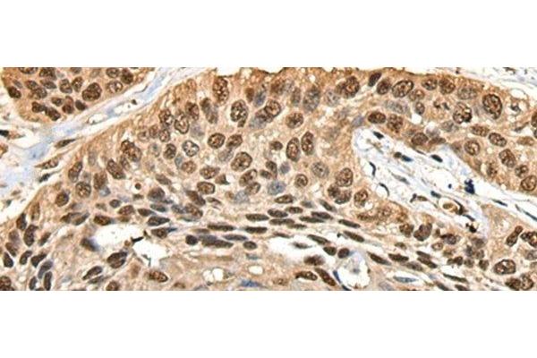 CCDC112 antibody