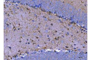 IHC analysis of Septin 2/SEPTIN2 using anti-Septin 2/SEPTIN2 antibody (ABIN7599275).