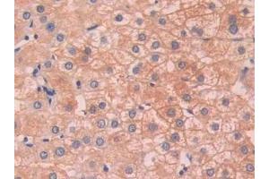 Detection of SAP in Human Liver Tissue using Polyclonal Antibody to Serum Amyloid P Component (SAP) (APCS antibody  (AA 23-223))