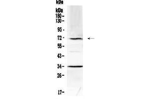 Western blot analysis of Alpha 1 Fetoprotein using anti-Alpha 1 Fetoprotein antibody . (alpha Fetoprotein antibody  (AA 19-254))