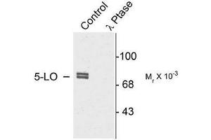 Image no. 1 for anti-Arachidonate 5-Lipoxygenase (ALOX5) (pSer523) antibody (ABIN372586) (ALOX5 antibody  (pSer523))