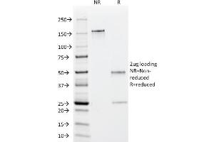SDS-PAGE Analysis Purified EBV Mouse Monoclonal Antibody (1108-1). (EBV EA antibody)