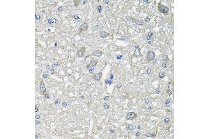 Immunohistochemistry of paraffin-embedded rat brain using GFPT1 antibody. (GFPT1 antibody  (AA 1-150))