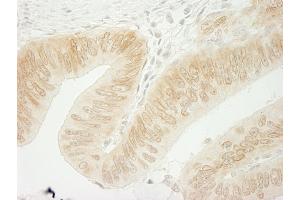 Immunohistochemistry (IHC) image for anti-Catenin (Cadherin-Associated Protein), delta 1 (CTNND1) (C-Term) antibody (ABIN7454707)