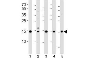 Western blot analysis of lysate from (1) 293T, (2) HeLa, (3) HL-60, (4) Jurkat cell lines and (5) rat liver tissue using SUMO2/3 antibody at 1:1000. (SUMO2/3 antibody  (AA 49-81))