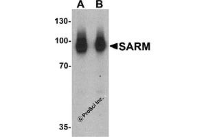 Western Blotting (WB) image for anti-Sterile alpha and TIR Motif Containing 1 (SARM1) (N-Term) antibody (ABIN1031550) (SARM1 antibody  (N-Term))