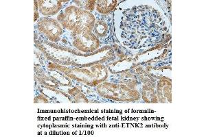 Image no. 1 for anti-Ethanolamine Kinase 2 (ETNK2) antibody (ABIN1576385) (Ethanolamine Kinase 2 antibody)