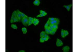 Immunofluorescence staining of HepG2 cells with ABIN7151530 at 1:166, counter-stained with DAPI. (ELMOD3 antibody  (AA 1-102))