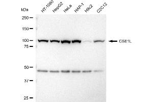 Western blotting analysis using CSE1L antibody (ABIN7798172).