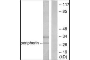 Western blot analysis of extracts from 293 cells, using PGP9. (UCHL1 antibody  (C-Term))