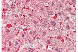 Rabbit Anti-ALDOB antibody  Formalin Fixed Paraffin Embedded Tissue: Human Liver Primary antibody Concentration: 1:100 Secondary Antibody: Donkey anti-Rabbit-Cy3 Secondary Antibody Concentration: 1:200 Magnification: 20x Exposure Time: 0. (ALDOB antibody  (N-Term))