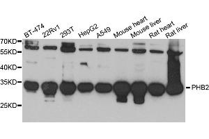 Western blot analysis of extracts of various cell lines, using PHB2 antibody. (Prohibitin 2 antibody)