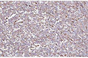 IHC analysis of DAB2 using anti-DAB2 antibody (ABIN7602613).