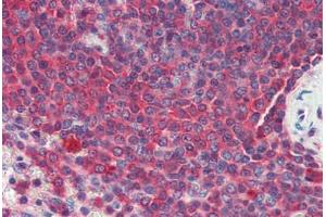 Human Spleen (formalin-fixed, paraffin-embedded) stained with Heat Shock Protein 90 (HSP90) antibody ABIN462104 at 10 ug/ml followed by biotinylated secondary antibody, alkaline phosphatase-streptavidin and chromogen. (HSP90 antibody)