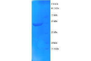 SDS-PAGE (SDS) image for NADH Dehydrogenase (Ubiquinone) 1 alpha Subcomplex, 1, 7.5kDa (NDUFA1) (AA 1-70), (full length) protein (GST tag) (ABIN1608027)