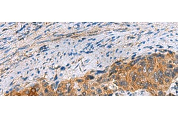 JOSD1 antibody