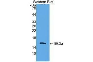 Detection of Recombinant UCP2, Human using Monoclonal Antibody to Mitochondrial Uncoupling Protein 2 (UCP2) (UCP2 antibody  (AA 154-289))