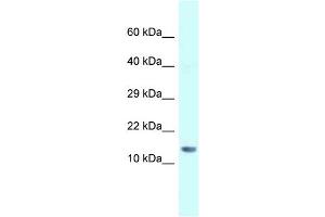 WB Suggested Anti-Gm14277 Antibody   Titration: 1. (Gm14277 antibody  (N-Term))