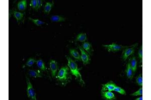 Immunofluorescent analysis of Hela cells using ABIN7149255 at dilution of 1:100 and Alexa Fluor 488-congugated AffiniPure Goat Anti-Rabbit IgG(H+L) (CYP2U1 antibody  (AA 363-496))