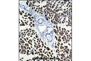 ACTA1 Antibody (ABIN1536597 and ABIN2843809) immunohistochemistry analysis in formalin fixed and paraffin embedded human skeletal muscle followed by peroxidase conjμgation of the secondary antibody and DAB staining. (Actin antibody)