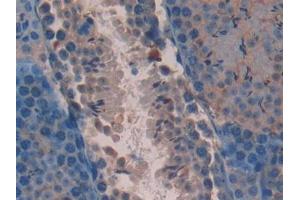 DAB staining on IHC-P; Samples: Mouse Testis Tissue (AATK antibody  (AA 137-386))