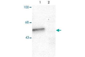 Western blot of mouse forebrain lysates from Wild Type (Control, lane 1) and Gabra1 knockout (Gabra1-K/O, lane 2) animals showing specific immunolabeling of the ~51 alpha1-subunit of the Gabra1. (GABRA1 antibody  (N-Term))