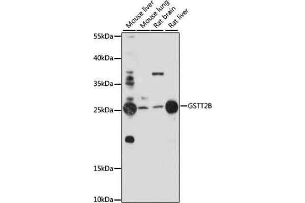 GSTT2B antibody  (AA 115-244)