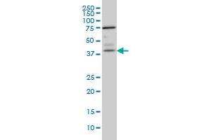 Western Blotting (WB) image for anti-Paraneoplastic Antigen MA1 (PNMA1) (AA 62-161) antibody (ABIN598600) (PNMA1 antibody  (AA 62-161))