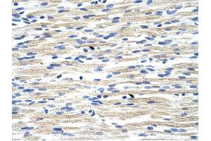CBX6 antibody was used for immunohistochemistry at a concentration of 4-8 ug/ml to stain Skeletal muscle cells (arrows) in Human Muscle.