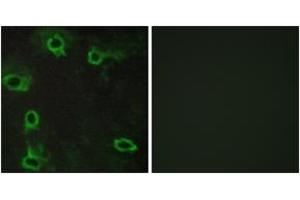 Immunofluorescence analysis of COS7 cells, using ADORA2A Antibody. (Adenosine A2a Receptor antibody  (AA 120-169))