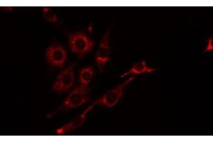 ABIN6274815 staining Hela by IF/ICC. (BST1 antibody  (Internal Region))