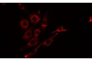 ABIN6274815 staining Hela by IF/ICC. (BST1 antibody  (Internal Region))