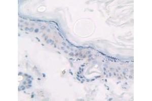 IHC-P analysis of Kidney tissue, with DAB staining. (KRT14 antibody  (AA 122-429))