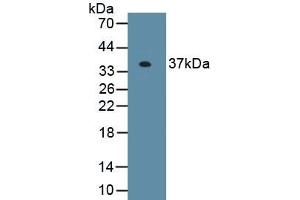 Detection of Recombinant EXOSC2, Human using Polyclonal Antibody to Exosome Component 2 (EXOSC2) (EXOSC2 antibody  (AA 1-293))
