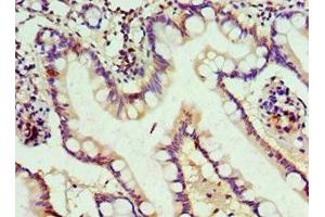 Immunohistochemistry of paraffin-embedded human small intestine tissue using ABIN7150217 at dilution of 1:100 (ALKBH2 antibody  (AA 1-261))