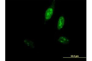 Immunofluorescence of purified MaxPab antibody to POLE3 on HeLa cell. (POLE3 antibody  (AA 1-147))