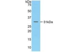 Detection of Recombinant MAdCAM1, Mouse using Polyclonal Antibody to Mucosal Addressin Cell Adhesion Molecule 1 (MAdCAM1) (MADCAM1 antibody  (AA 29-297))
