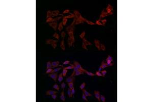 Immunofluorescence analysis of PC-12 cells using OP antibody (ABIN6129426, ABIN6145031, ABIN6145032 and ABIN6225150) at dilution of 1:100 (40x lens). (OPA1 antibody  (AA 661-960))