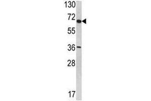 Western Blotting (WB) image for anti-Synovial Apoptosis Inhibitor 1, Synoviolin (SYVN1) (AA 586-617) antibody (ABIN3029082)