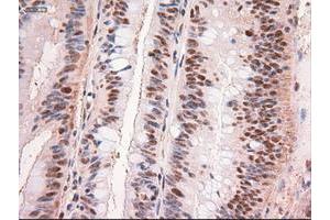 Image no. 1 for anti-Myc Proto-Oncogene protein (MYC) antibody (ABIN1497012) (c-MYC antibody)