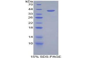 SDS-PAGE analysis of Human Hemojuvelin Protein. (HFE2 Protein)