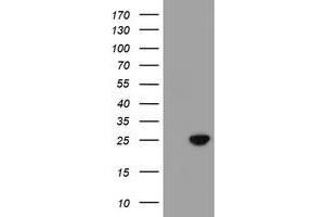 HEK293T cells were transfected with the pCMV6-ENTRY control (Left lane) or pCMV6-ENTRY C21orf56 (Right lane) cDNA for 48 hrs and lysed. (C21ORF56 antibody)