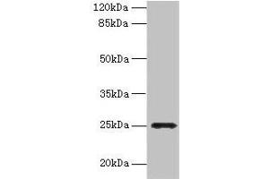 Western blot All lanes: FGFBP2 antibody at 2 μg/mL + Human serum Secondary Goat polyclonal to rabbit IgG at 1/10000 dilution Predicted band size: 25 kDa Observed band size: 25 kDa (FGFBP2 antibody  (AA 20-223))